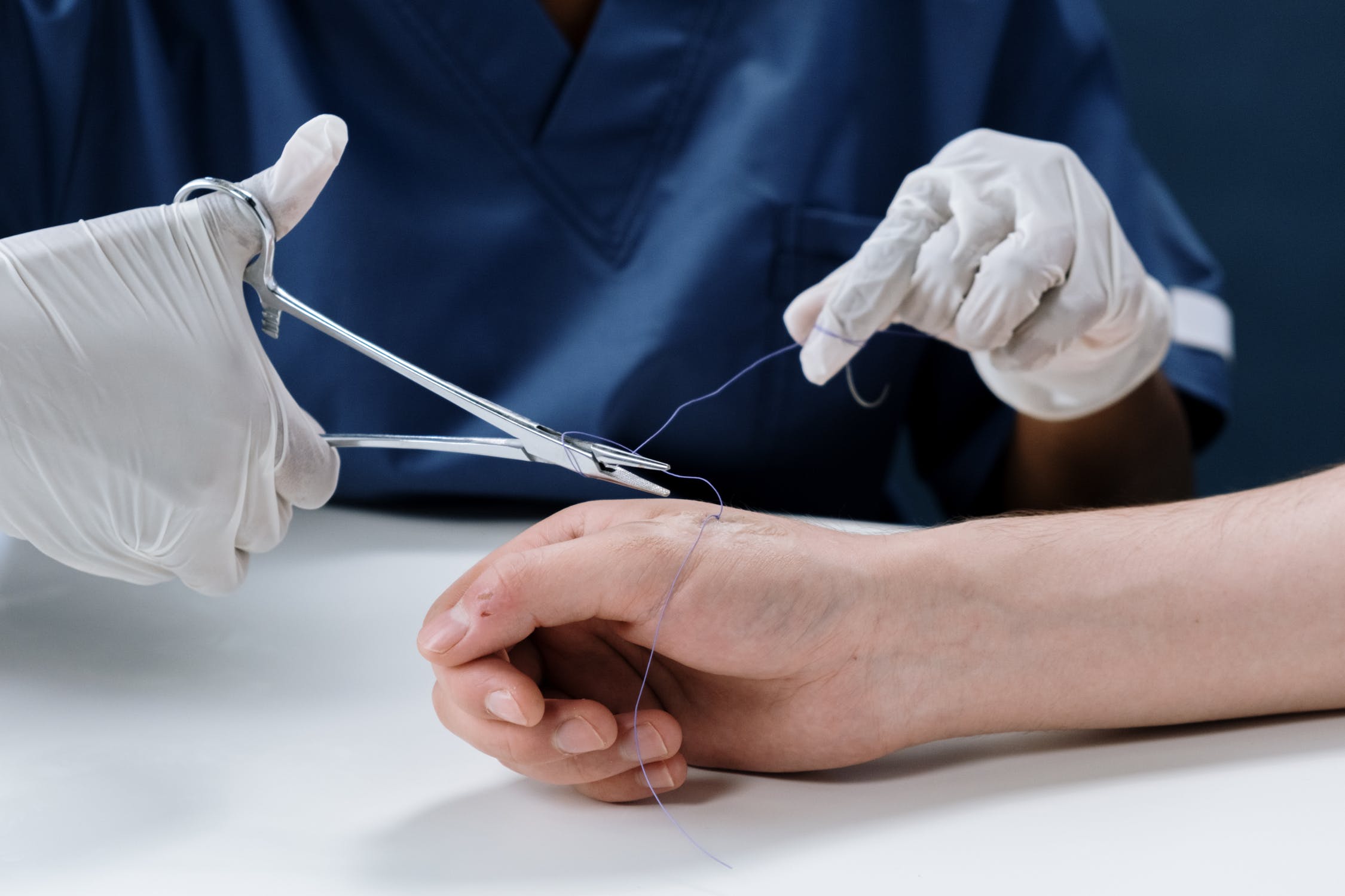 Knowing When a Cut Needs Stitches: Casa de Salud: Primary Care