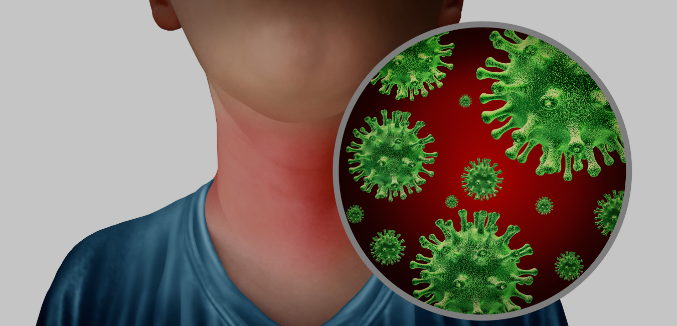 how-long-does-strep-throat-last-bacterial-image